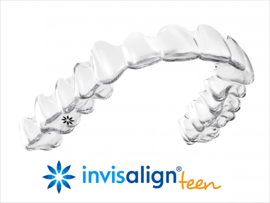 中高生のマウスピース矯正 - 豊中市岡町で歯列矯正治療なら、まつもと歯科